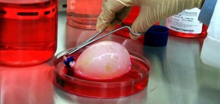 3D printed organs to be expected in 2014 source: http://graphicashen.com/technology/first-3d-printed-organ-liver-expected-2014/